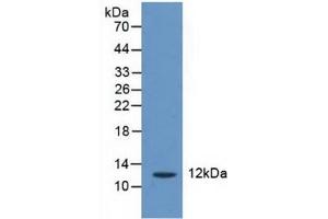 Detection of CRADD in Human Liver Tissue using Polyclonal Antibody to CASP2 And RIPK1 Domain Containing Adaptor With Death Domain Protein (CRADD) (CRADD 抗体  (AA 1-199))