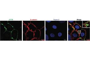 Expression of CFTR in human Caco-2 cellsImmunocytochemical staining of human epithelial colorectal adenocarcinoma cells using Anti-CFTR Antibody (ABIN7043096, ABIN7044127 and ABIN7044128).