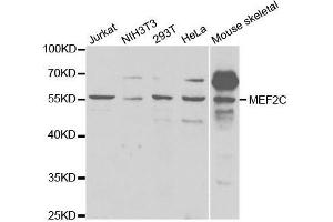 Western blot analysis of extracts of various cell lines, using MEF2C antibody. (MEF2C 抗体  (AA 170-380))