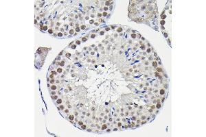 Immunohistochemistry (IHC) image for anti-Karyopherin alpha 3 (Importin alpha 4) (KPNA3) (AA 1-210) antibody (ABIN6142991)