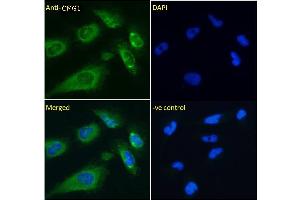 ABIN6391342 Immunofluorescence analysis of paraformaldehyde fixed U251 cells, permeabilized with 0. (IFT74 抗体)