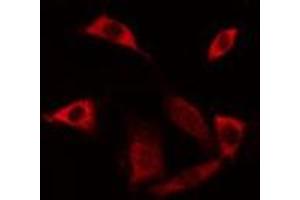 ABIN6275523 staining Hela cells by IF/ICC. (Septin 6 抗体  (Internal Region))