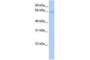 WB Suggested Anti-GATAD2B Antibody Titration:  0. (GATAD2B 抗体  (N-Term))