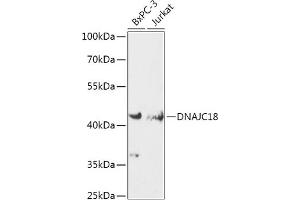 Western blot analysis of extracts of various cell lines, using DN antibody (ABIN7266825) at 1:1000 dilution. (DNAJC18 抗体  (AA 260-350))