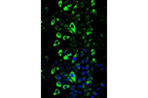 Immunofluorescence analysis of U2OS cells using GZMB antibody. (GZMB 抗体  (AA 148-247))