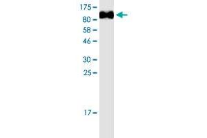 Image no. 1 for Melanoma Cell Adhesion Molecule (MCAM) (AA 24-646) protein (His-DYKDDDDK-Strep II Tag) (ABIN2752854)