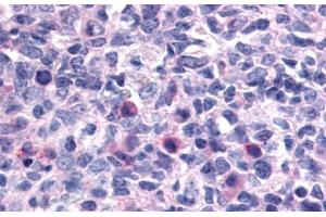 Anti-CXCR1 antibody  ABIN1048469 IHC staining of human lymph node. (CXCR1 抗体  (N-Term))