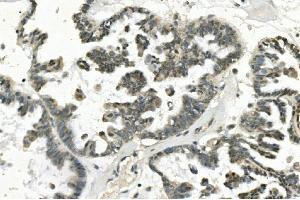 IHC analysis of PHEX using anti-PHEX antibody (ABIN7600072). (PHEX 抗体  (AA 145-718))