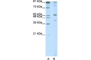 WB Suggested Anti-REXO4 Antibody Titration:  1. (REXO4 抗体  (N-Term))