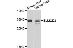 Western blot analysis of extracts of mouse liver and moues brain using ELMOD2 antibody. (ELMOD2 抗体)
