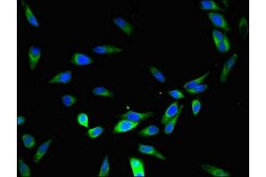 Immunofluorescent analysis of Hela cells using ABIN7150853 at dilution of 1:100 and Alexa Fluor 488-congugated AffiniPure Goat Anti-Rabbit IgG(H+L) (Dynein Assembly Factor 4, Axonemal (DNAAF4) (AA 109-295) 抗体)