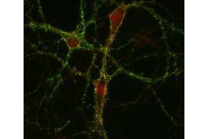 Immunocytochemistry (ICC) image for anti-GABA Transporter 1 (GAT1) (AA 585-599) antibody (ABIN1742535) (SLC6A1 抗体  (AA 585-599))