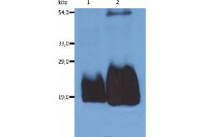 Western Blotting analysis (non-reducing conditions) of whole cell lysate of HPB-ALL human peripheral blood T cell leukemia cell line using anti-CD59 (MEM-43/5).