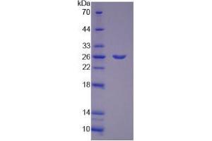 SDS-PAGE analysis of Mouse PYGM Protein. (PYGM 蛋白)