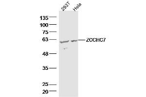 Lane 1: 293T lysates Lane 2: hela lysates probed with ZCCHC7 Polyclonal Antibody, Unconjugated  at 1:300 dilution and 4˚C overnight incubation. (ZCCHC7 抗体  (AA 401-500))