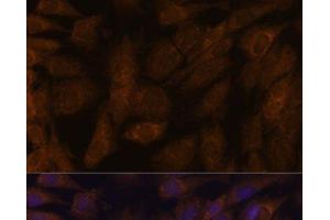Immunofluorescence analysis of C6 cells using TXNRD1 Polyclonal Antibody at dilution of 1:100. (TXNRD1 抗体)