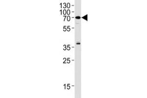 RIPK2 antibody western blot analysis in Raji lysate (RIPK2 抗体  (AA 39-68))