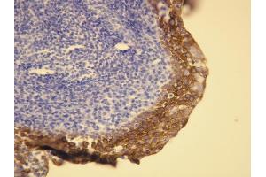 Immunohistochemistry (IHC) image for anti-Keratin 5/6 (KRT5/6) (AA 548-564), (C-Term) antibody (ABIN7598763) (Keratin 5/6 抗体  (C-Term))