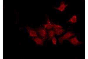 ABIN6274421 staining LOVO by IF/ICC. (TUSC5 抗体  (N-Term))