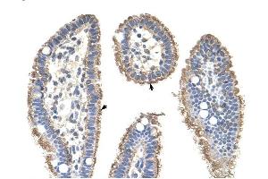 KRT2A antibody was used for immunohistochemistry at a concentration of 4-8 ug/ml to stain Epithelial cells of intestinal villus (arrows) in Human Intestine. (Keratin 2 抗体  (Middle Region))