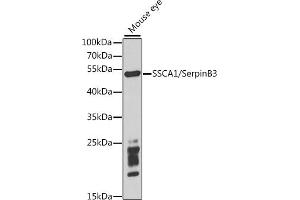 Western blot analysis of extracts of mouse eye, using SSC/SerpinB3 antibody (ABIN6131348, ABIN6147587, ABIN6147588 and ABIN6221070) at 1:1000 dilution. (SERPINB3 抗体  (AA 1-230))