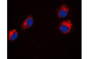Immunofluorescent analysis of Semaphorin 4A staining in HeLa cells. (Sema4a 抗体  (Center))