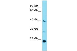 Western Blotting (WB) image for anti-Glucose 6-Phosphatase, Catalytic 3 (G6PC3) (Middle Region) antibody (ABIN2789896)