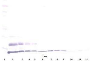 Image no. 1 for anti-Chemokine (C-C Motif) Ligand 15 (CCL15) antibody (Biotin) (ABIN465724) (CCL15 抗体  (Biotin))