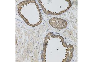 Immunohistochemistry of paraffin-embedded human prostate using CASP12 antibody.