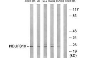 Western blot analysis of extracts from COLO/Jurkat/HeLa/HepG2/HuvEc cells, using NDUFB10 Antibody. (NDUFB10 抗体  (AA 63-112))