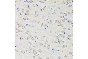 Immunohistochemistry of paraffin-embedded rat brain using YWHAZ antibody (ABIN5975846) at dilution of 1/100 (40x lens). (14-3-3 zeta 抗体)
