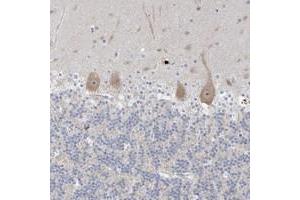 Immunohistochemical staining of human cerebellum with SDAD1 polyclonal antibody  shows moderate cytoplasmic and nucleolar positivity in Purkinje cells. (SDAD1 抗体)