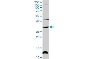 CENPP MaxPab rabbit polyclonal antibody. (CENPP 抗体  (AA 1-288))