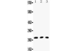 Anti-TNF beta antibody, All Western blottingAll lanes: Anti-TNF beta at 0. (LTA 抗体  (N-Term))