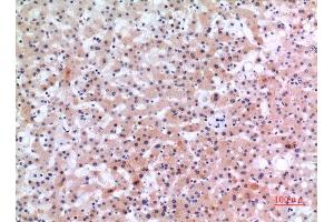 Immunohistochemistry (IHC) image for anti-Inhibin, beta E (INHBE) (C-Term) antibody (ABIN3187819)