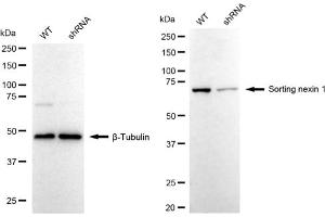 Western blotting analysis using Sorting nexin 1 antibody (ABIN7800408).