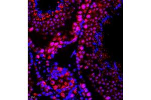 Immunofluorescence of paraffin embedded mouse testis using SR140 (ABIN7076091) at dilution of 1:600 (400x lens) (SR140 抗体)