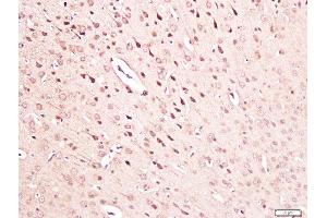 Paraformaldehyde-fixed, paraffin embedded mouse brain tissue, Antigen retrieval by boiling in sodium citrate buffer(pH6) for 15min, Block endogenous peroxidase by 3% hydrogen peroxide for 30 minutes, Blocking buffer (normal goat serum) at 37°C for 20min, Antibody incubation with Rabbit Anti-NGF Polyclonal Antibody, Unconjugated  at 1:300 overnight at 4°C, followed by a conjugated secondary and DAB staining (NGFB 抗体  (AA 151-220))