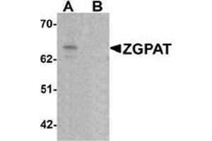 Western blot analysis of ZGPAT in SK-N-SH cell lysate with ZGPAT antibody at 1 ug/mL in (A) the absence and (B) the presence of blocking peptide.