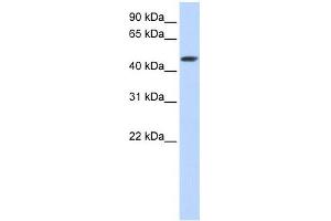 SULT2B1 antibody used at 1 ug/ml to detect target protein. (SULT2B1 抗体  (C-Term))