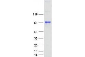 Western Blotting (WB) image for Tyrosyl-DNA Phosphodiesterase 1 (TDP1) (Transcript Variant 2) protein (Myc-DYKDDDDK Tag) (ABIN2733392)