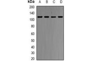 Western blot analysis of HMGCR expression in HepG2 (A), Hela (B), mouse spleen (C), rat liver (D) whole cell lysates. (HMGCR 抗体)