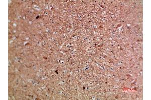 Immunohistochemistry (IHC) image for anti-Artemin (ARTN) (AA 101-150) antibody (ABIN7189414)