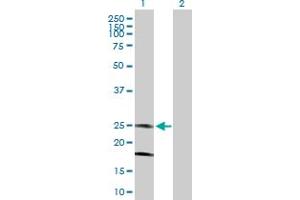Western Blot analysis of KCNMB4 expression in transfected 293T cell line by KCNMB4 MaxPab polyclonal antibody. (KCNMB4 抗体  (AA 1-210))