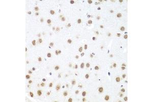 Immunohistochemistry (Paraffin-embedded Sections) (IHC (p)) image for anti-DEAD (Asp-Glu-Ala-Asp) Box Polypeptide 39B (DDX39B) (AA 319-428) antibody (ABIN6139492)