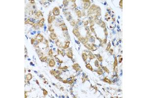 Immunohistochemistry of paraffin-embedded human stomach using ANTXR2 antibody (ABIN5975032) at dilution of 1/100 (40x lens). (ANTXR2 抗体)