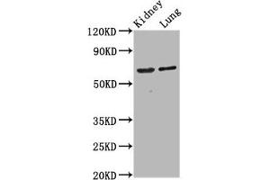 Western Blot Positive WB detected in: Rat kidney tissue, Mouse lung tissue All lanes: SRRM4 antibody at 4. (SRRM4 抗体  (AA 400-479))