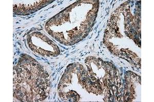 Immunohistochemical staining of paraffin-embedded pancreas tissue using anti-PIM2 mouse monoclonal antibody.