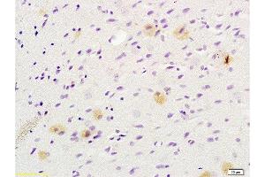 Immunohistochemistry (Paraffin-embedded Sections) (IHC (p)) image for anti-Tumor Susceptibility Gene 101 (TSG101) (AA 4-120) antibody (ABIN685507)