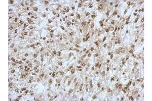 Image no. 2 for anti-Sin3A-Associated Protein, 130kDa (SAP130) (N-Term) antibody (ABIN1494118) (SAP130 抗体  (N-Term))